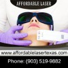 Affordable Laser Texas